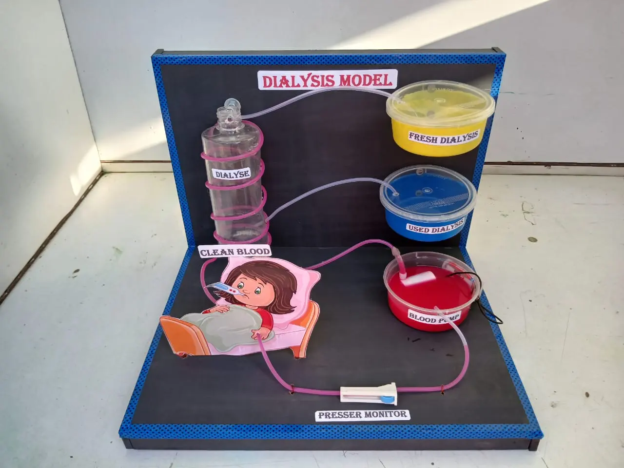 Handmade working dialysis model with labelled blood-pump and tubing components